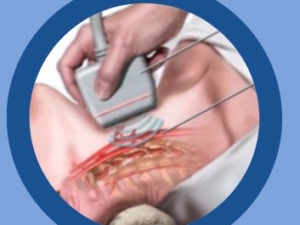 2 vasos del cuello 2 vasos del cuello